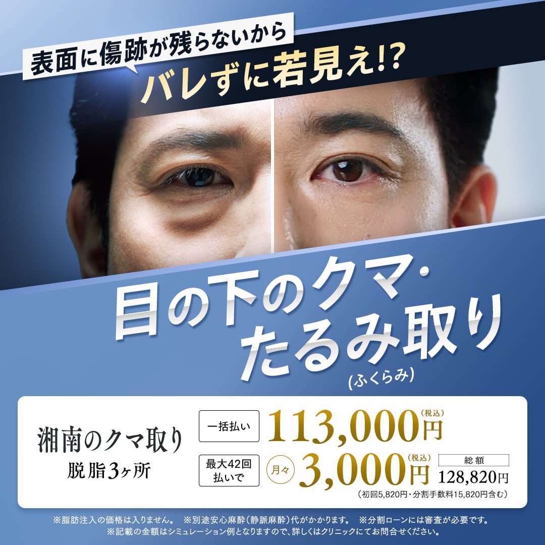 バレずに若見え!?目の下のクマ・たるみ（ふくらみ）取り