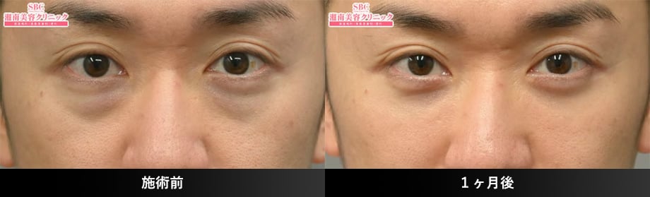 30代症例写真