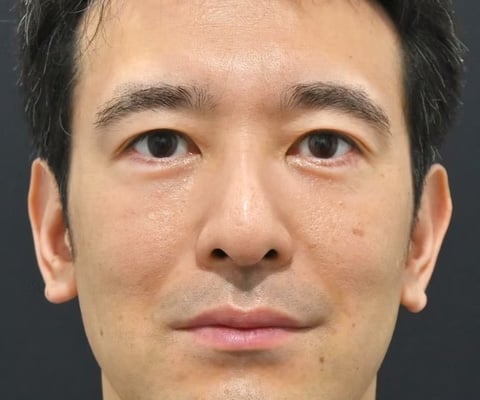 症例写真02_after