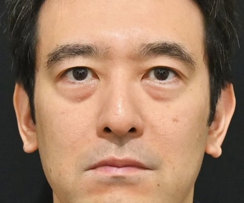 症例写真02_before