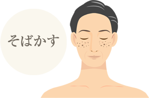 そばかす