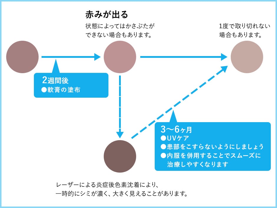 シミ取り後の経過