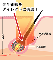 湘南の医療脱毛