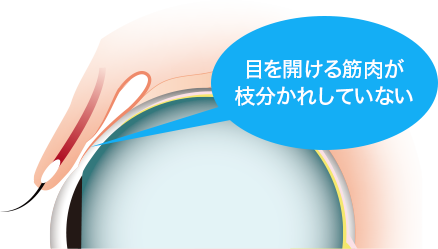 一重まぶた01