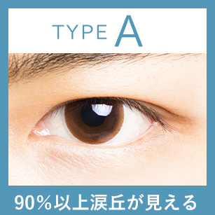 90%以上涙丘が見える