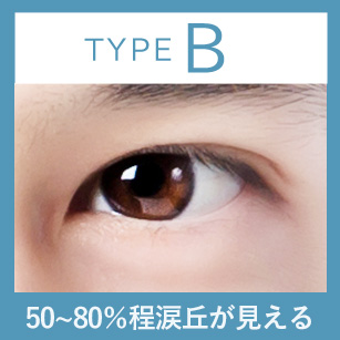 50〜80%程涙丘が見える