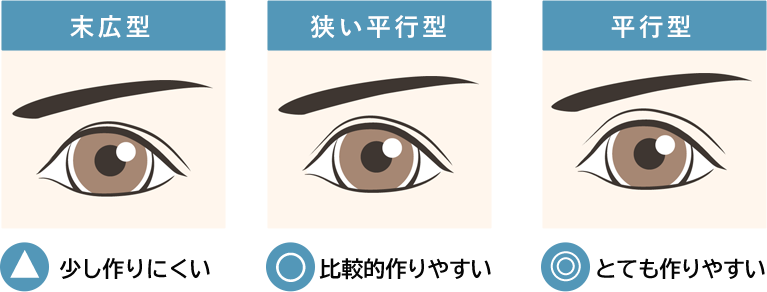 A TYPEの方