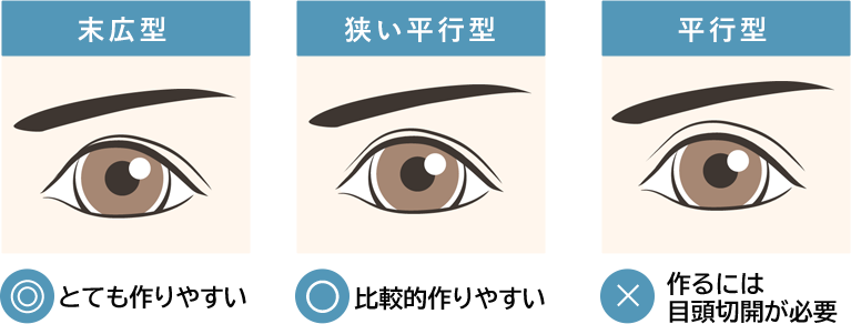 B TYPEの方
