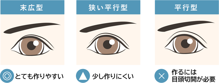 C TYPEの方