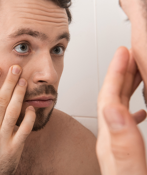 このような男性（メンズ）は眼瞼下垂の傾向がある？