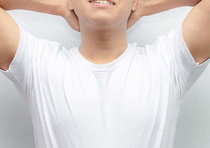 わきが・多汗症