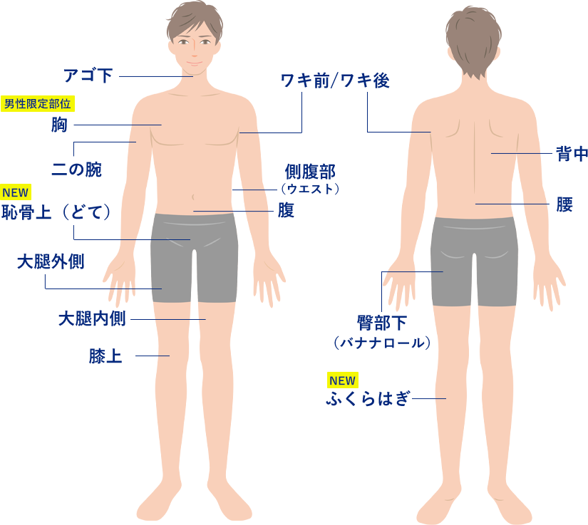 男性のクールスカルプティング®エリート（クルスカダブル）施術対象部位