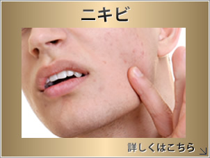 ニキビ