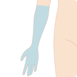 男性脱毛 腕(両ひじ下) 部位:両腕(両ひじ下)