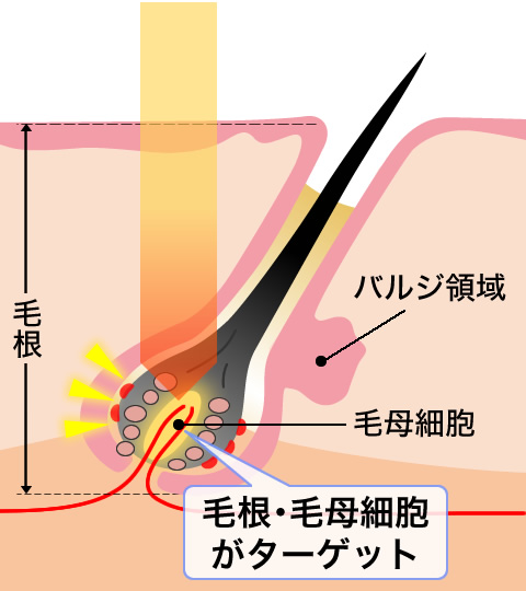 アプローチ場所 毛根・毛母細胞がターゲット